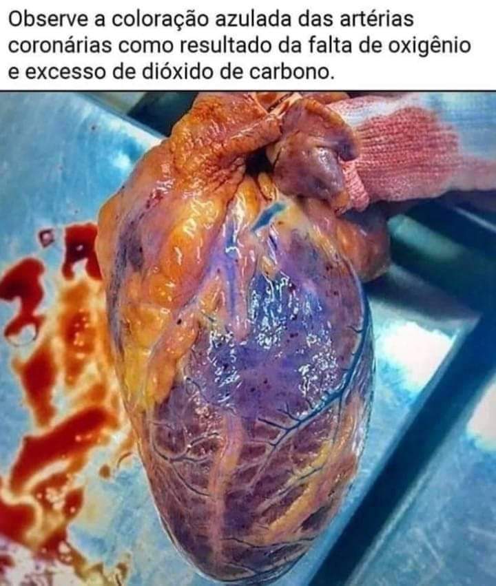 É falso: Uso prolongado de máscara produz&nbsp;hipóxia