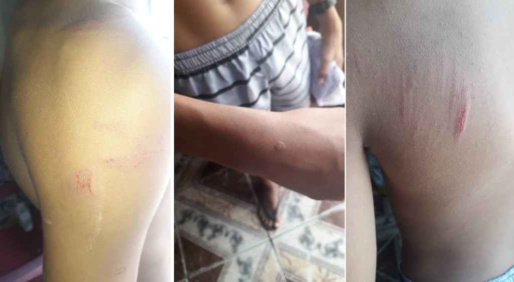 Parte do teto de escola municipal de Matinha cai e deixa alunos&nbsp;feridos