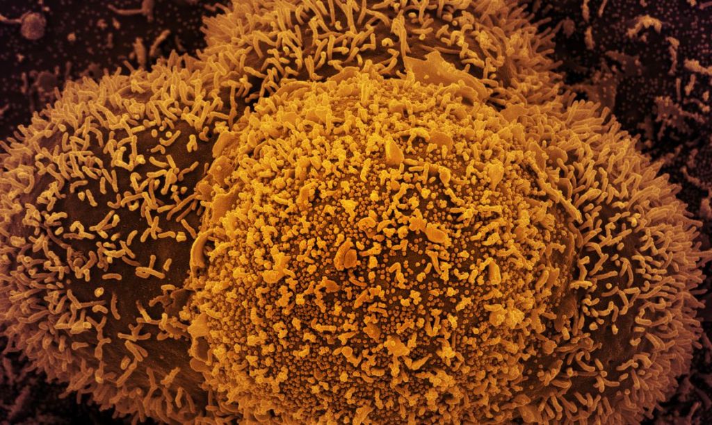 Anvisa: dois casos da variante Ômicron são identificados no&nbsp;Brasil