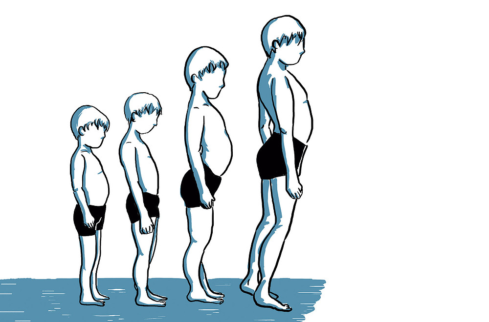 Quais são as principais causas da Distrofia Muscular de&nbsp;Duchenne?