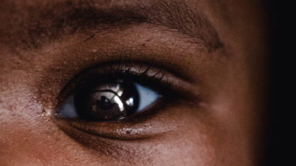 Retinoblastoma: o que é o tumor ocular que afeta a filha de Tiago&nbsp;Leifert