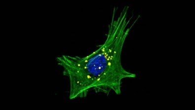 Estudo revela como o desequilíbrio da microbiota intestinal pode levar à doença de Parkinson