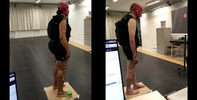 Estudo confirma período de eficácia de medicamento para controle postural em pacientes com&nbsp;Parkinson