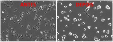 Peptídeo criado por grupo brasileiro retarda avanço do melanoma em testes com&nbsp;animais