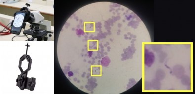Técnica baseada em inteligência artificial permite detectar a doença de Chagas usando imagens de&nbsp;celular