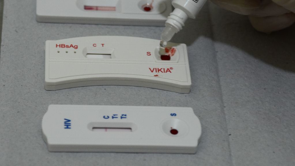 Experiência brasileira no enfrentamento às hepatites virais traz aprendizados para lidar com novas emergências de&nbsp;saúde