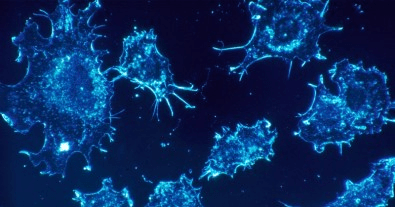 Tratamentos contra o câncer que modificam geneticamente células de defesa avançam no Estado de São&nbsp;Paulo