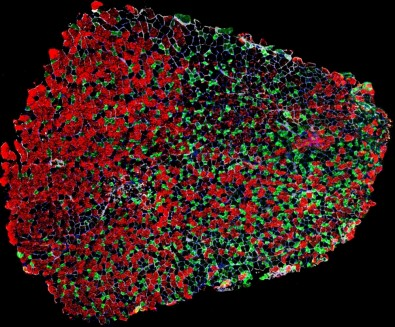 Falta de vitamina D na gestação pode afetar o desenvolvimento muscular dos descendentes, sugere&nbsp;estudo