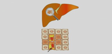 Falta do aminoácido metionina na dieta pode favorecer o acúmulo de gordura no fígado, sugere&nbsp;estudo
