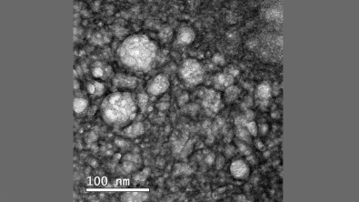 Cientistas testam molécula que combina três tecnologias distintas contra o câncer cerebral mais agressivo