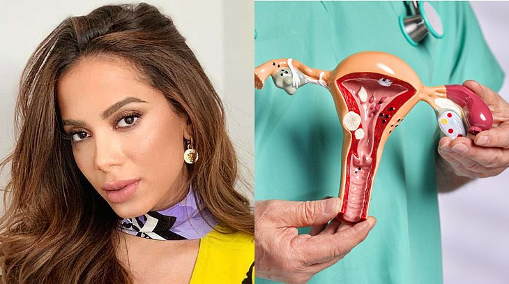 Vivendo Normalmente Com&nbsp;ENDOMETRIOSE