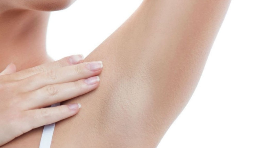 Manchas na pele? Saiba como cuidar&nbsp;