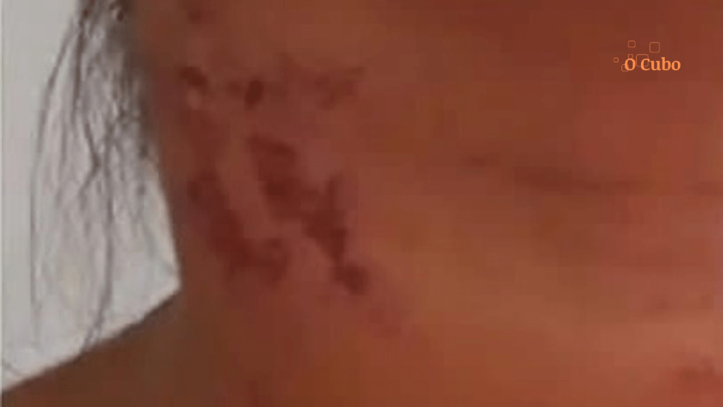 Homem morde menina no pescoço em São José dos&nbsp;Basílios