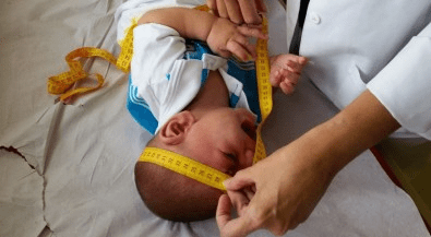 Zika provoca anormalidade em quase um terço dos filhos de mulheres infectadas na&nbsp;gravidez