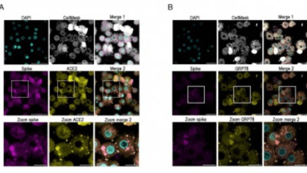 Pesquisa da USP revela que o vírus da COVID-19 pode causar diabetes em pacientes&nbsp;internados
