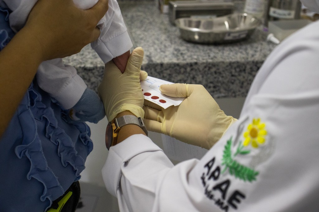 APAE de São Luís amplia o Teste do Pezinho e inclui a testagem de&nbsp;Toxoplasmose