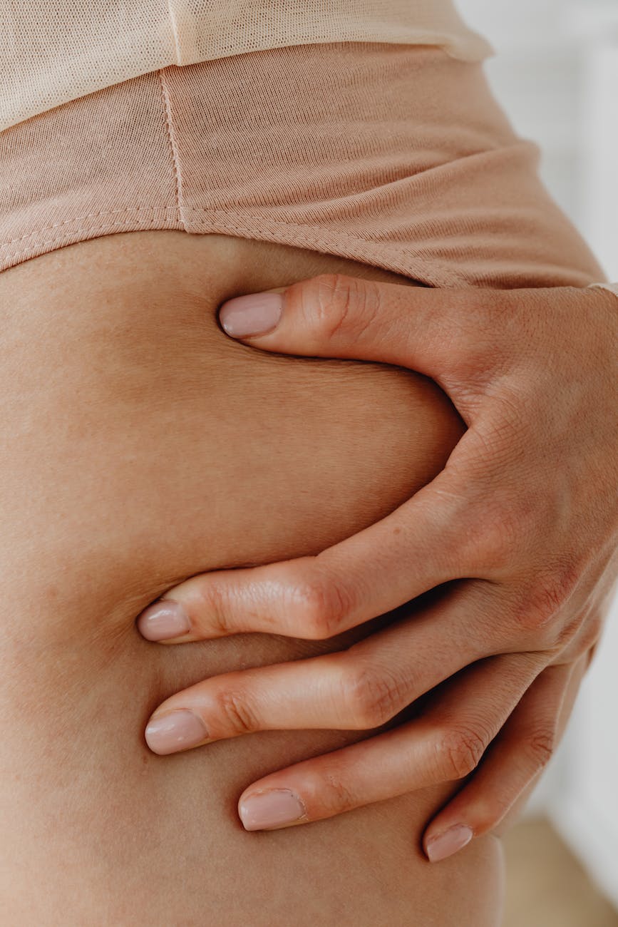 Estrias e Flacidez: Dá Para&nbsp;Evitar?