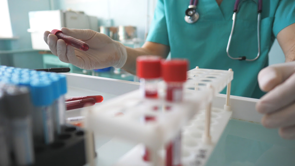 Saiba quais doenças podem ser detectadas em exames de sangue, fezes e&nbsp;urina