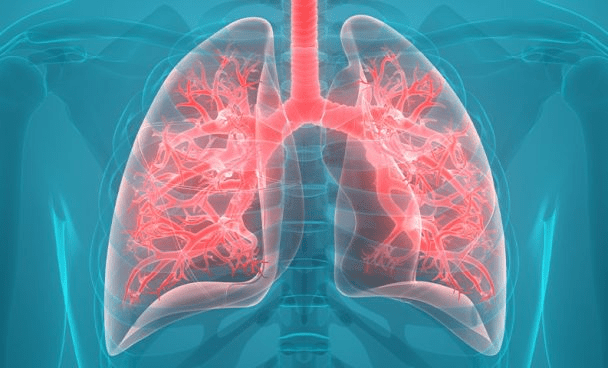 Câncer de pulmão é o mais mortal entre os homens e o 2º entre&nbsp;mulheres