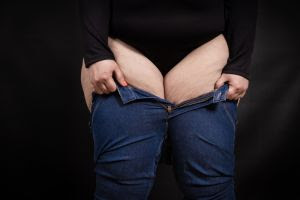 Obesidade X Lipedema: por que a doença de Juliane Massaoka é tão comum de ser&nbsp;confundida