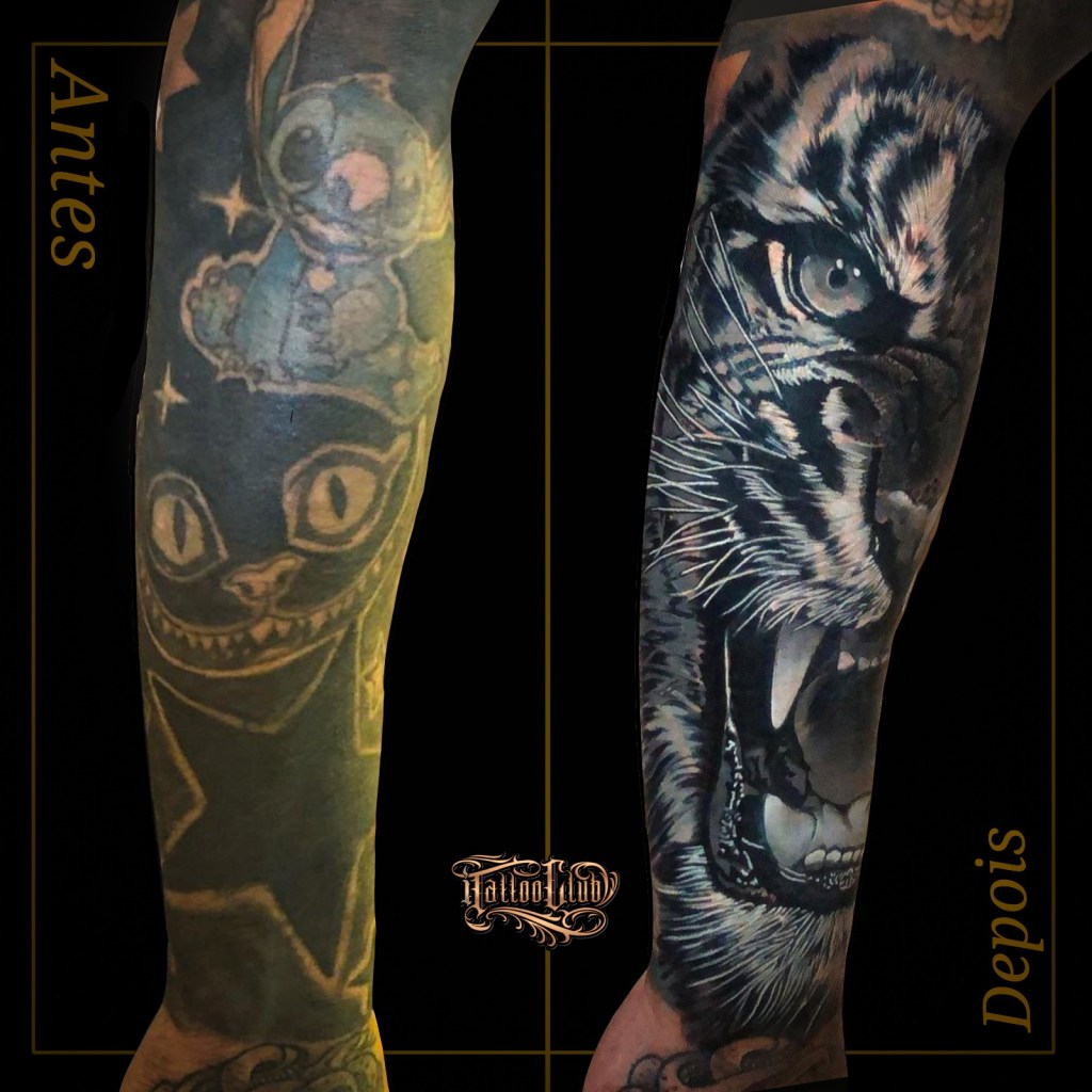 Remoção ou cobertura de tatuagem, qual&nbsp;escolher?