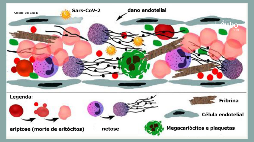 Novo estudo comprova que a COVID-19 grave é uma doença&nbsp;trombótica