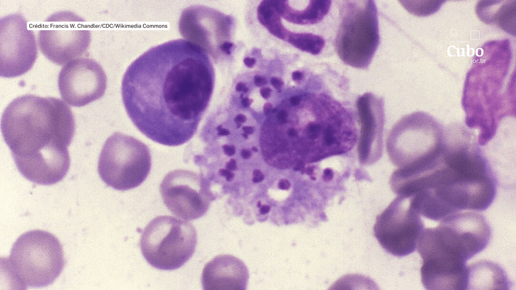 Teste permite detectar coinfecção por nova espécie de parasita em casos graves de leishmaniose&nbsp;visceral