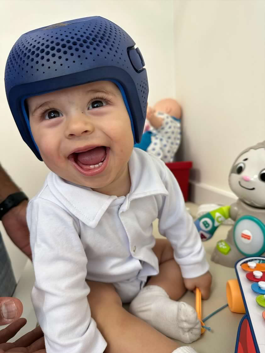 Descobri que a cabecinha do meu bebê é ‘amassada’: e&nbsp;agora?