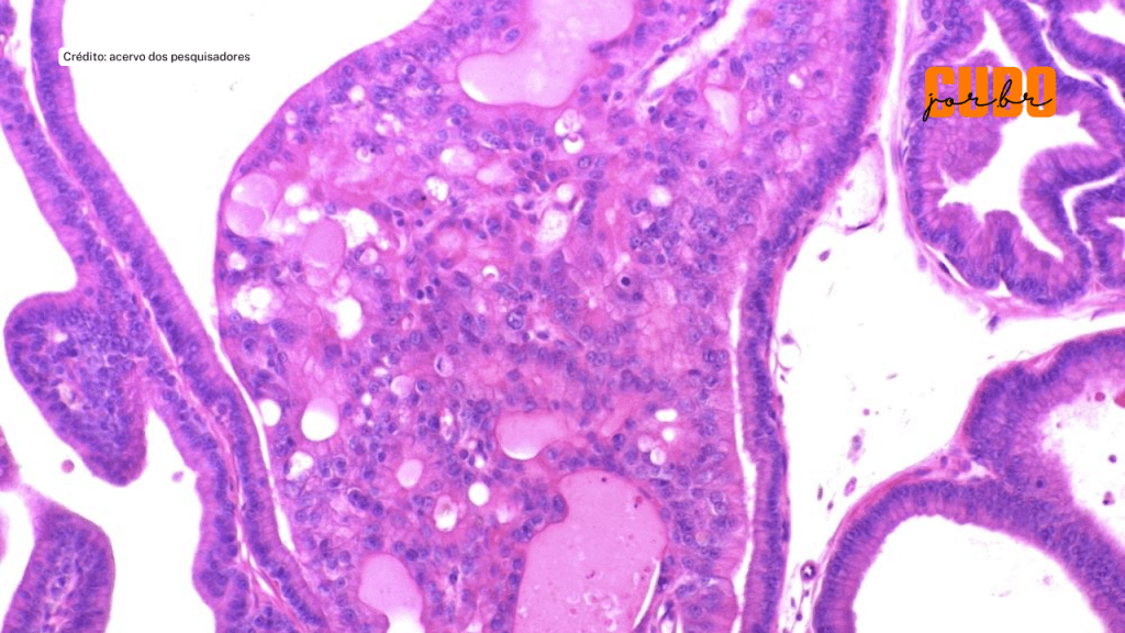 Estudo explica por que dieta pobre em proteína na gestação eleva o risco de câncer de próstata na&nbsp;prole
