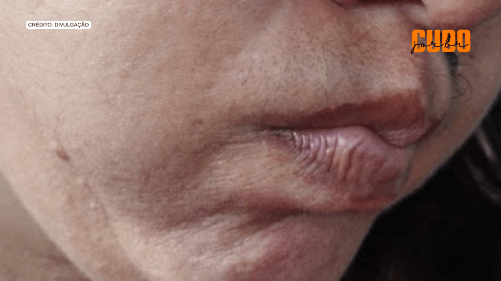 Professora agredida por policial militar em São Luís relata medo&nbsp;constante