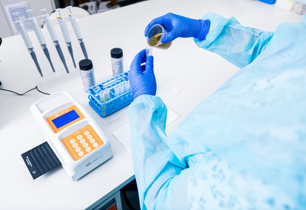 Urina escura pode indicar problemas graves nos&nbsp;rins