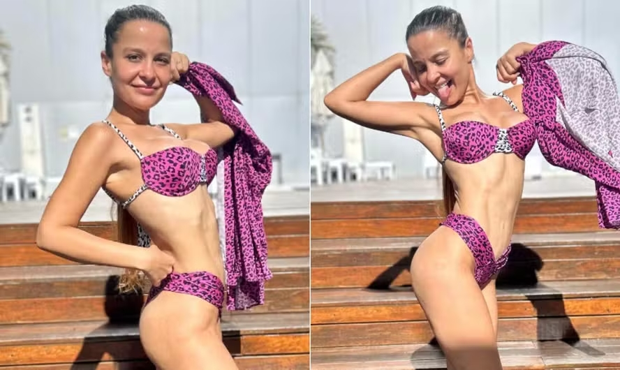 Conheça os riscos da ninfoplastia realizada por&nbsp;Maiara