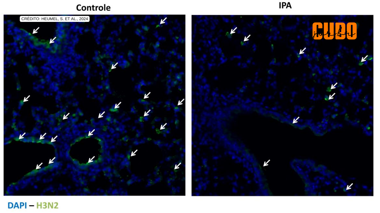 Molécula produzida no intestino pode ter efeito protetor contra gripe, indica estudo