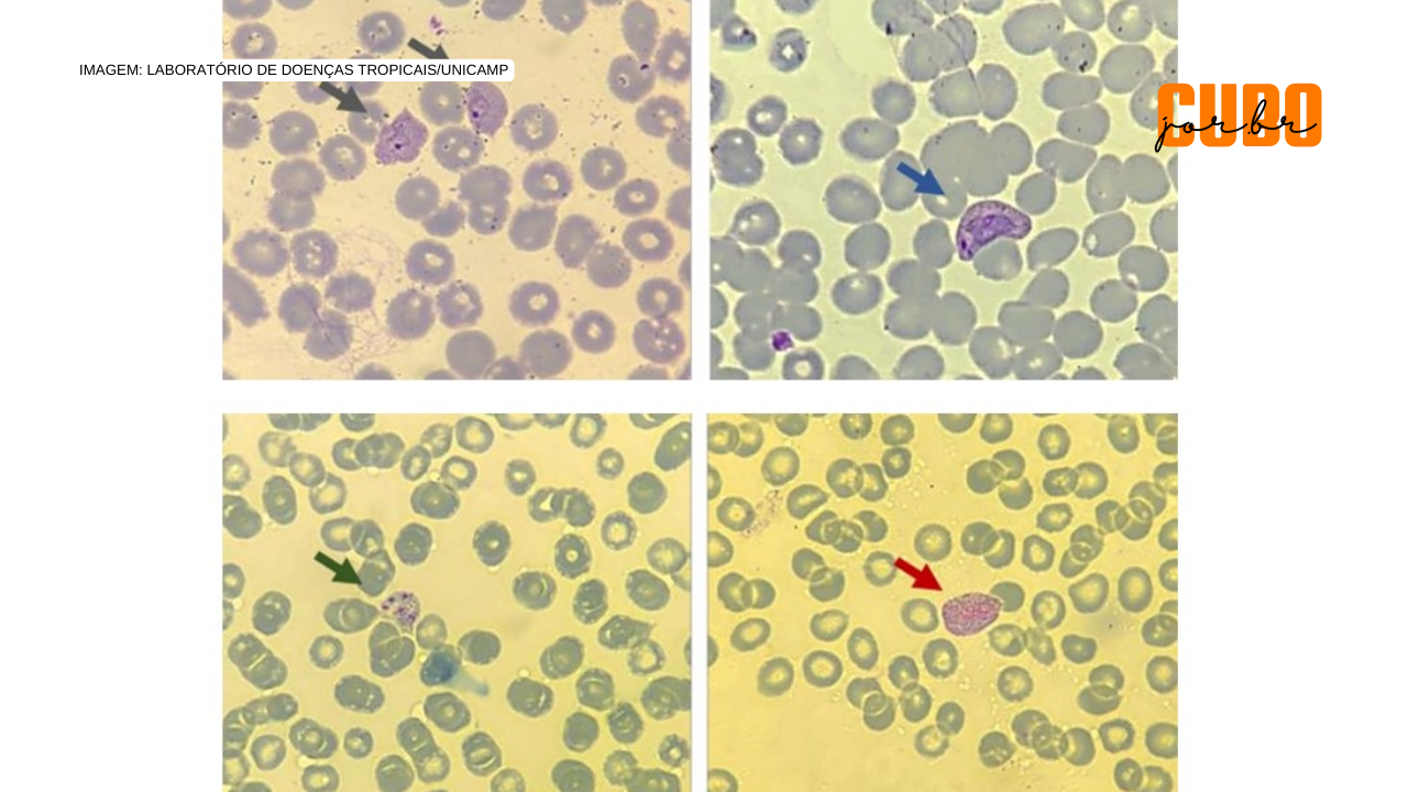 Cientistas identificam, no sangue de pacientes com malária, moléculas associadas ao risco de recaída