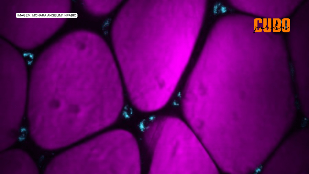 Estudo revela novo fator associado ao risco de COVID-19 grave em pessoas com&nbsp;obesidade