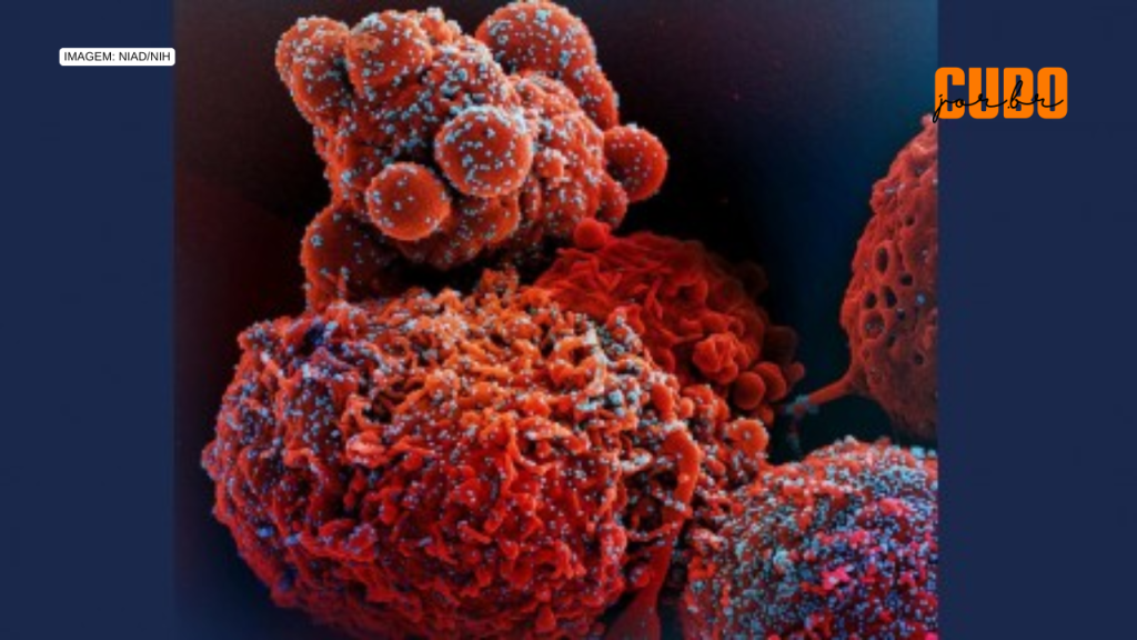 Para subverter a resposta imune, vírus da COVID estimula a produção de proteínas sem função&nbsp;protetora