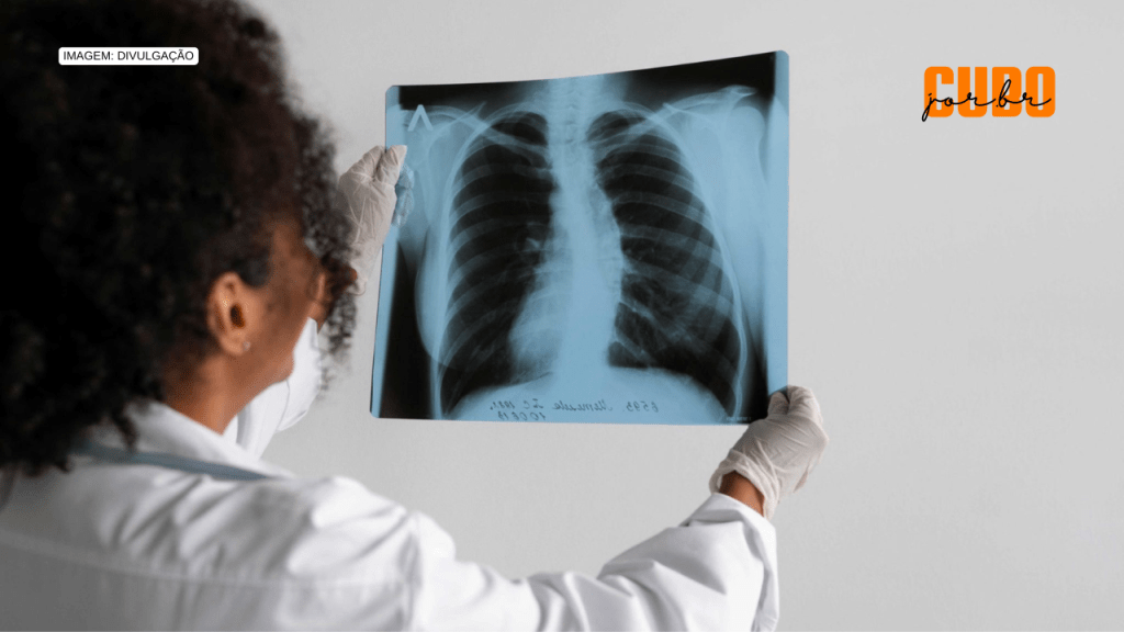 Adolescentes negros são os que mais abandonam tratamento para tuberculose no estado de SP, aponta&nbsp;estudo