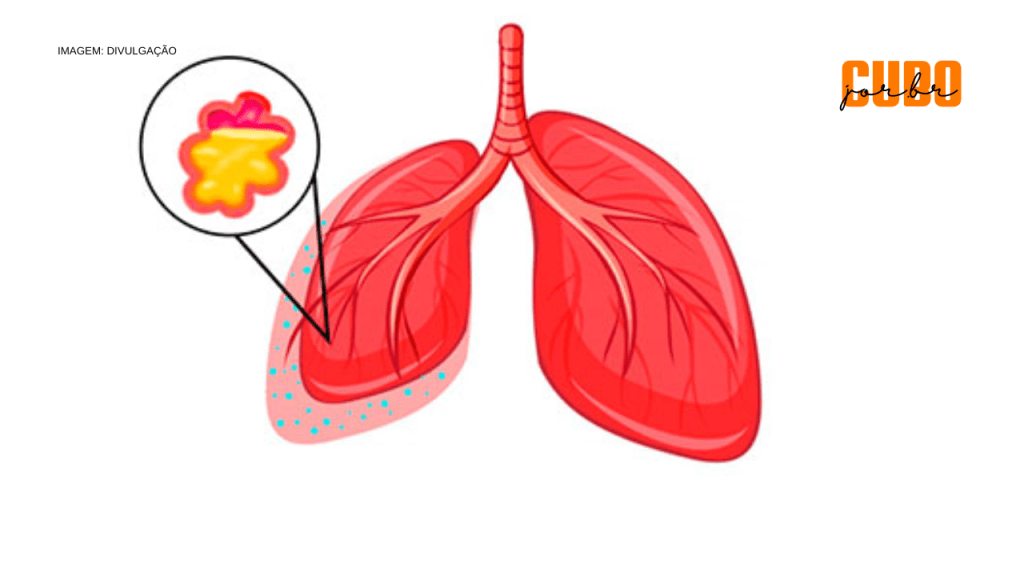 Ambulatório do HU-UFMA acolhe pacientes com Fibrose&nbsp;Cística