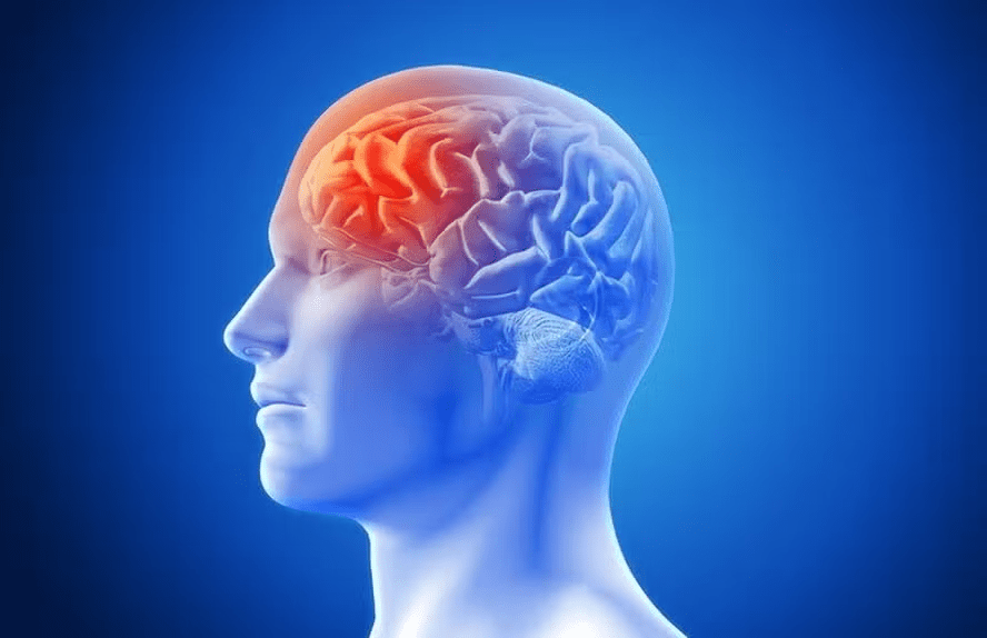 Dia do AVC: Sintomas, prevenção e tratamento, saiba tudo sobre a&nbsp;condição