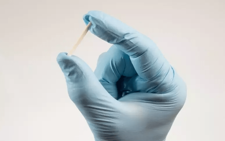 Como ficam os pacientes que usavam o “chips da beleza” após&nbsp;proibição?