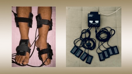 Terapia à base de luz reduz dor associada à neuropatia diabética periférica, comprova&nbsp;estudo