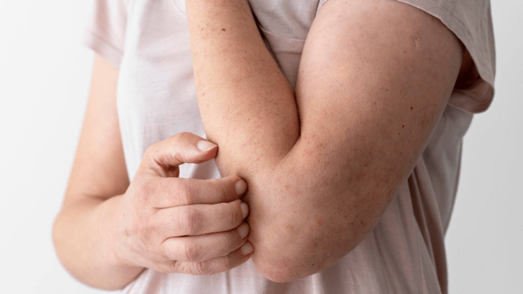 Janeiro roxo: Campanha incentiva combate à hanseníase no&nbsp;Brasil