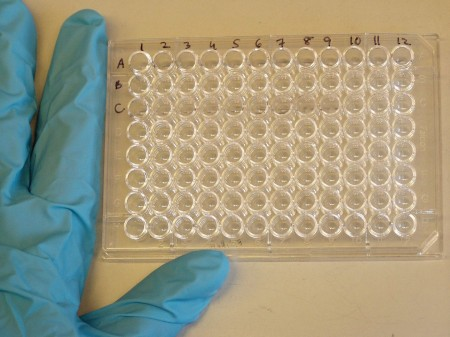 Teste permite identificar infecção prévia por zika e pelos quatro sorotipos do vírus da dengue