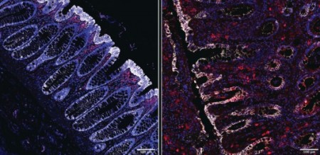 Consumo de fibras protege intestino contra infecção bacteriana grave, sugere estudo