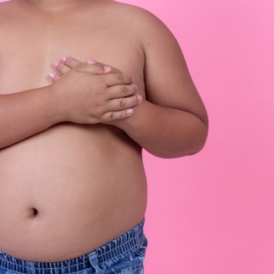 Obesidade infantil causa danos vasculares precoces, indica estudo com crianças&nbsp;paulistas